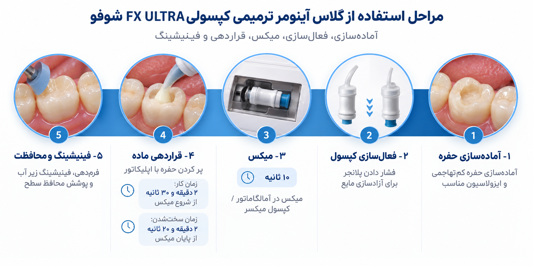گلاس آینومر ترمیمی کپسولی FX ULTRA شوفو
