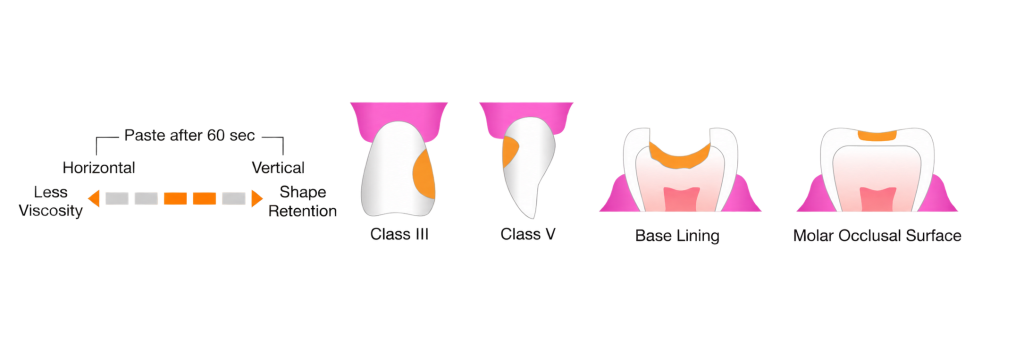 کامپوزیت مدیوم فلو Beautifil Injectable XSL شوفو